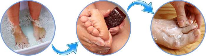Инструкция по применению спрея Feet protect.